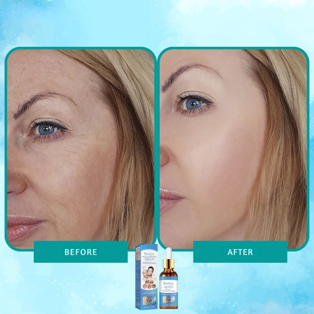 Siero botox elisir anti-rughe intenso 