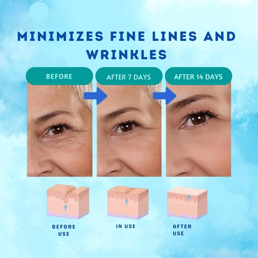 Intenzív ránctalanító Botox szérum elixír 