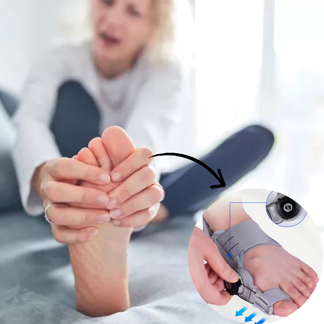 Corrigeer uw bunions zonder pijn of operatie 