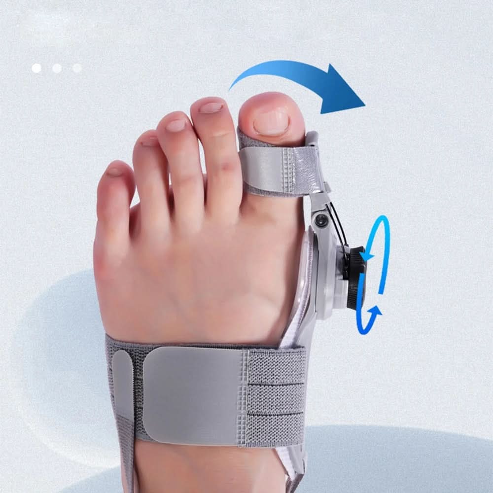Corrigeer uw bunions zonder pijn of operatie 