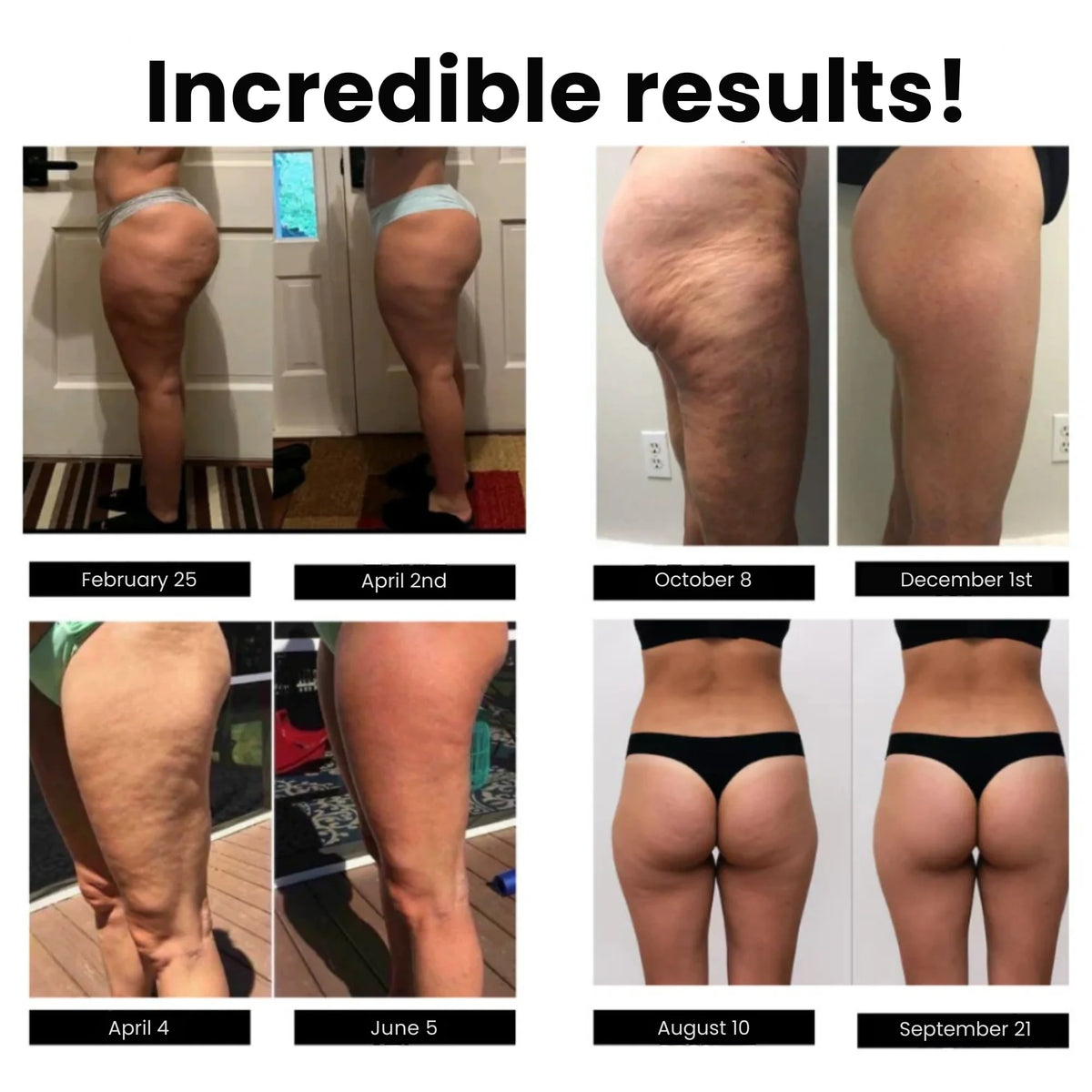 Leggings anticellulite — foto 4